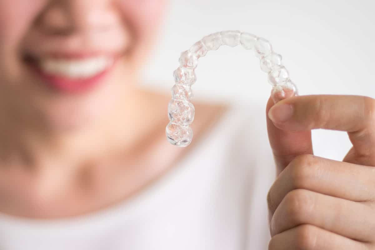 Clear Aligners Image